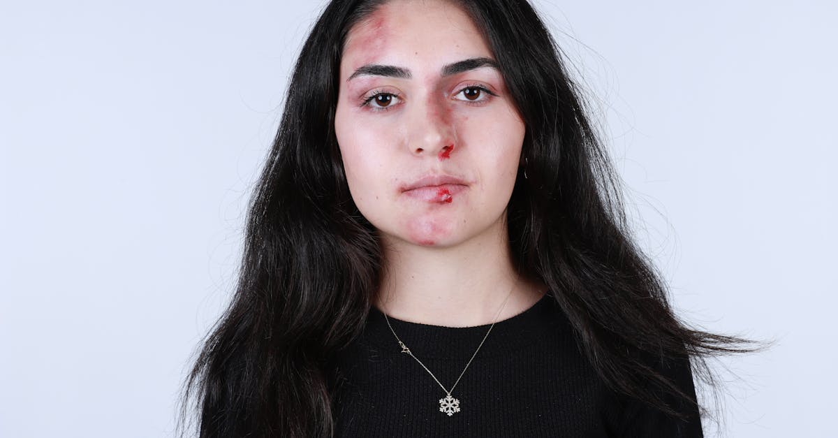 découvrez les blessures narcissiques, leurs causes et leurs impacts sur la vie quotidienne. apprenez à reconnaître les signes de la souffrance narcissique et explorez des stratégies pour guérir et retrouver une saine estime de soi.