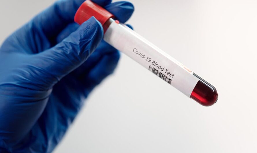 La jalousie pathologique : comprendre ses causes et ses conséquences