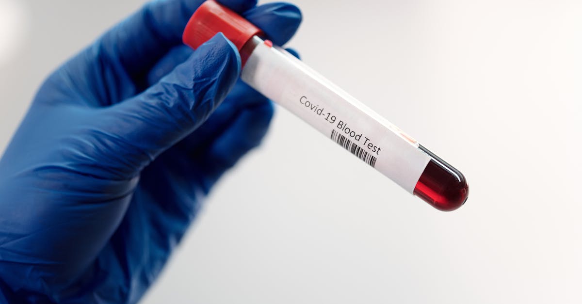 la jalousie pathologique est un trouble émotionnel caractérisé par des inquiétudes intenses et irrationnelles concernant la fidélité d'un partenaire. découvrez ses causes, ses manifestations et des stratégies pour la surmonter afin de retrouver l'équilibre dans vos relations.