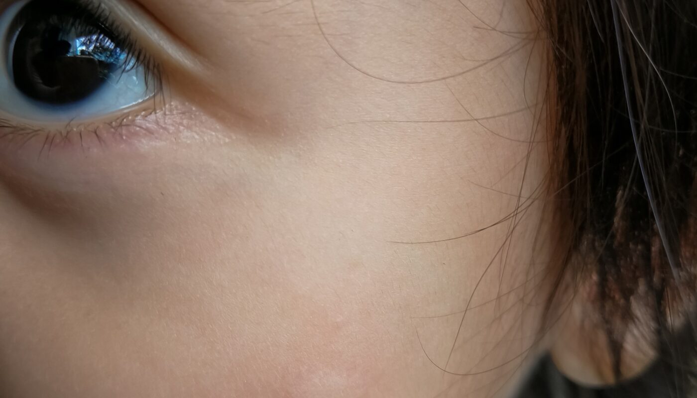 Image principale pour Qu'est-ce que la dermatophagie : 5 façons de savoir comment arrêter de mordre la peau des doigts