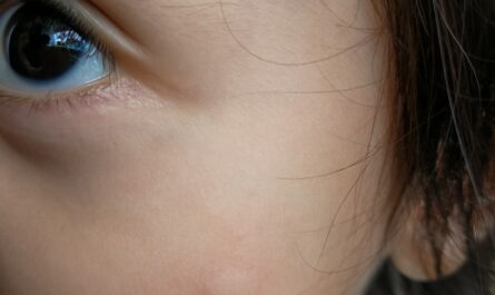 Image principale pour Qu'est-ce que la dermatophagie : 5 façons de savoir comment arrêter de mordre la peau des doigts